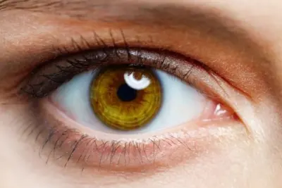 Cílios postiços, maquiagem e limpeza inadequada elevam riscos de blefarite, doença confundida com conjuntivite, alerta oftalmologista do H.Olhos