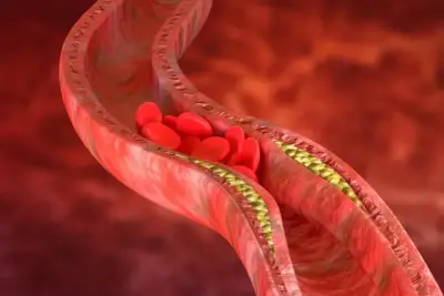 Vilão ou mocinho? Descubra como o colesterol afeta a sua saúde cardiovascular