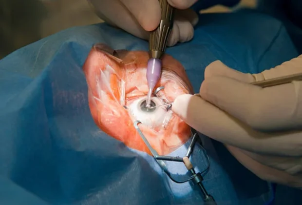 Prefeitura de Mogi Mirim investe quase R$ 2 milhões em cirurgias eletivas de catarata e ortopedia