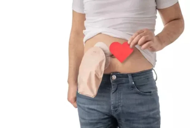 Câmara de Artur Nogueira aprova Lei que estabelece o atendimento preferencial as pessoas que utilizam bolsa de colostomia, ileostomia e urotosmia