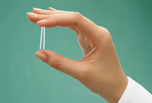 Mogi Mirim capacita médicos para uso de implante contraceptivo de longa duração