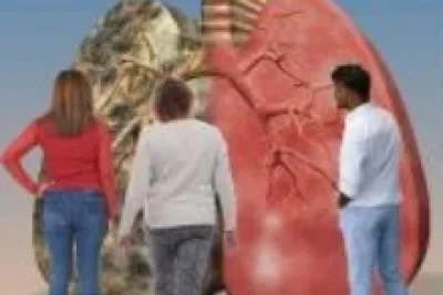Paulínia recebe pela primeira vez pulmão gigante do Grupo SOnHe