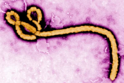 São Paulo investiga caso suspeito de Ebola em paciente internado no Emílio Ribas