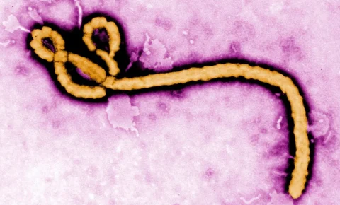São Paulo investiga caso suspeito de Ebola em paciente internado no Emílio Ribas