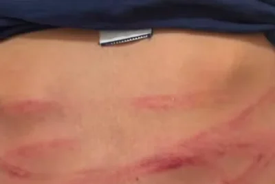 Homem é preso por tortura após enteado de 12 anos procurar atendimento sozinho em Artur Nogueira